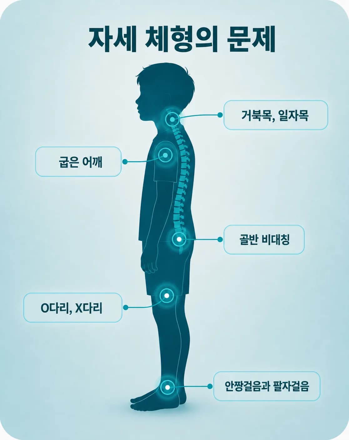 목·어깨·등·척추·다리·발·얼굴에서 나타나는 아이 자세·체형 문제 부위 그림 — 거북목·라운드숄더·척추측만·평발·O자 다리(내반슬)·X자 다리·안짱걸음·팔자걸음
