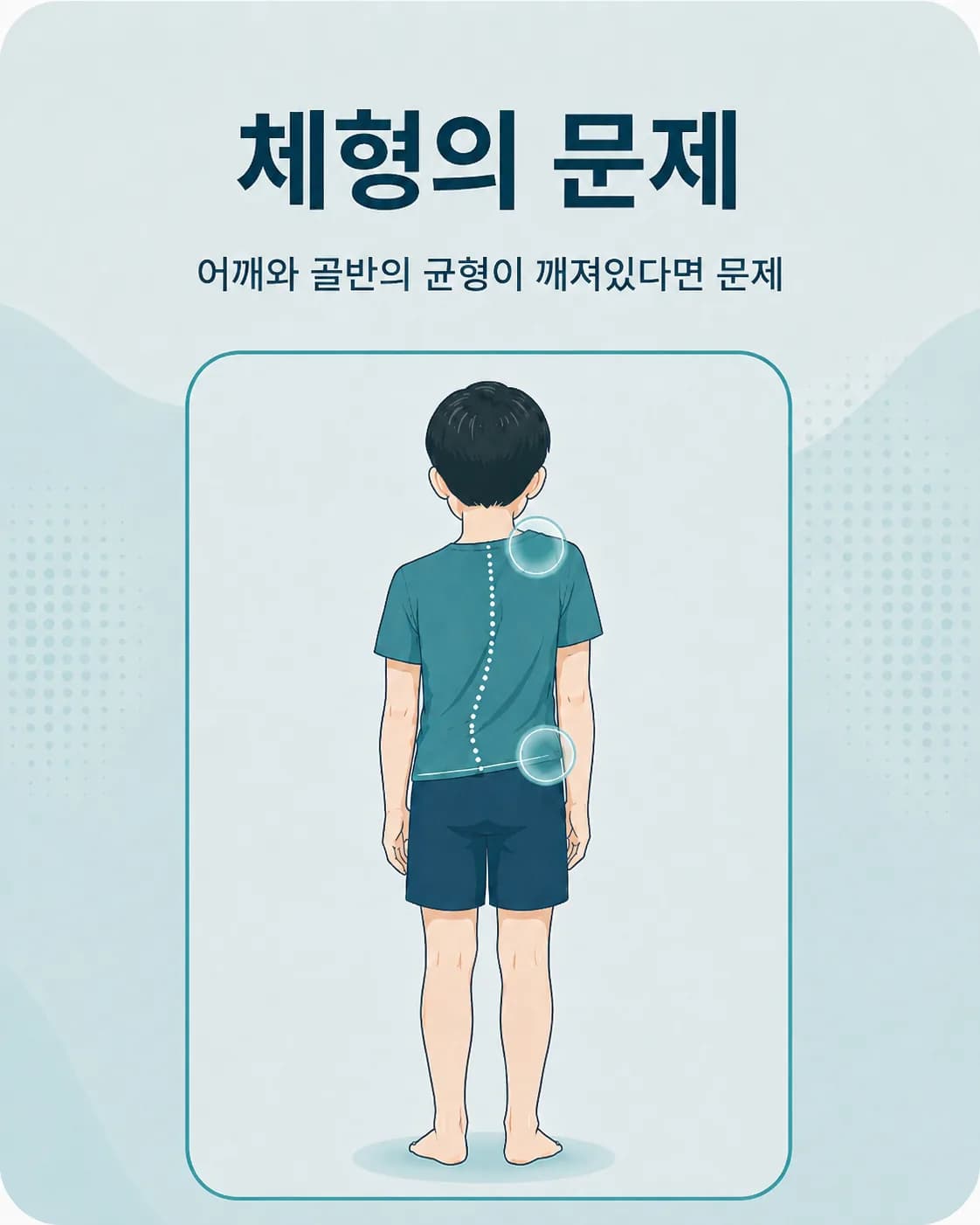 자세를 바꿨을 때 모양이 달라지는지로 자세·체형을 구분하는 도식